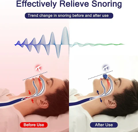 Maskiton Micro CPAP Kuorsauksen Estolaite Kompakti Matkustukseen - Image 4